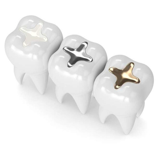 Anveli Dental - Décontamination aux métaux lourd