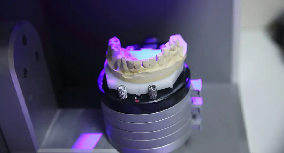 los implantes dentales tecnología anveli