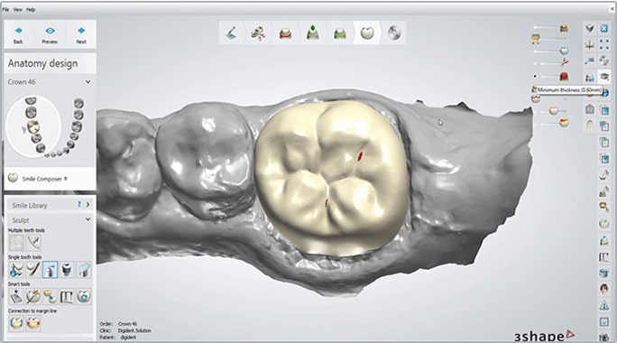 Dental Laboratory Anveli Dental Basal Implants