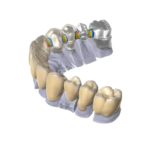 fixed prosthesis anveli dental