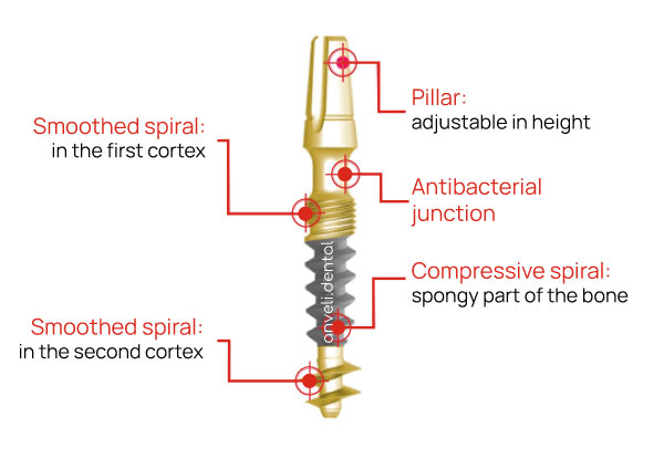 Dental implants anveli dental basal implant