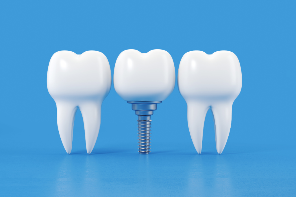 3 coronas, 2 de dientes sanos y 1 de implante dental. 